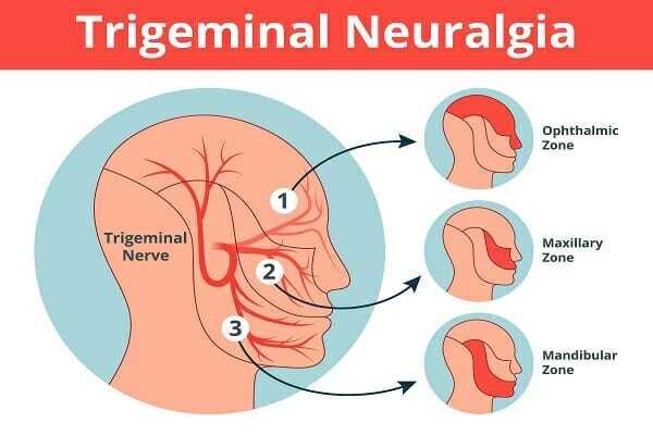 Medical Illustration