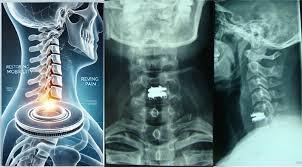 Medical Illustration