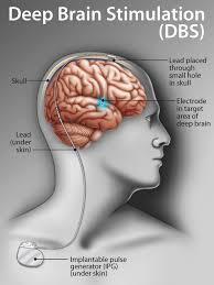 Medical Illustration
