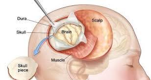 Medical Illustration