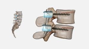 Medical Illustration