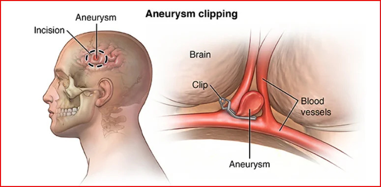 Medical Illustration